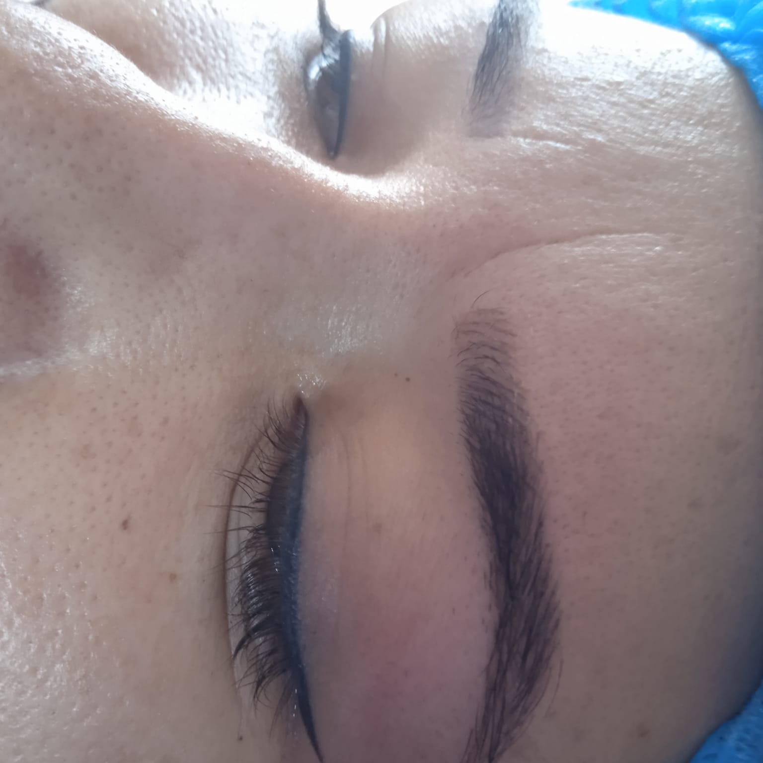 Corrección y arreglo de cejas en Popayán